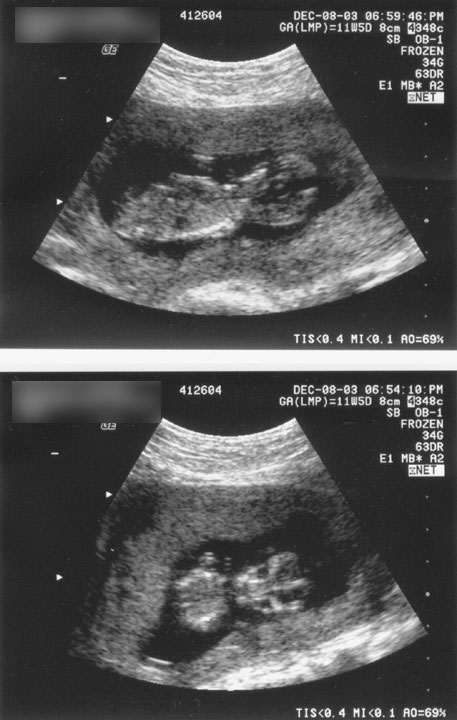 12_2003_ultrasound.jpg